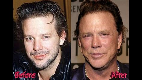 mickey rourke|mickey rourke before and after.